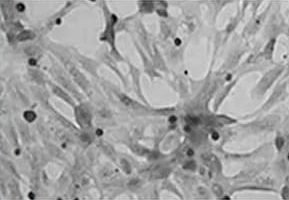 Magnified skin surface before, with clogged pores